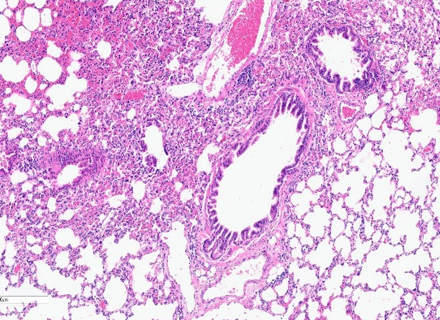 Mouse lung HE staining