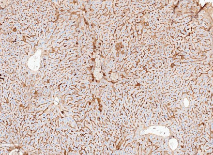 Mouse liver CD3 IHC staining